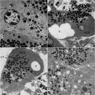 Western diet-induced ultrastructural changes in mouse pancreatic acinar cells